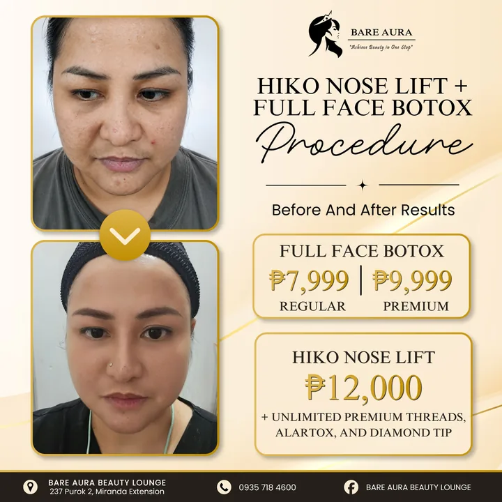 Before-and-after post: Hiko nose lift and full face botox