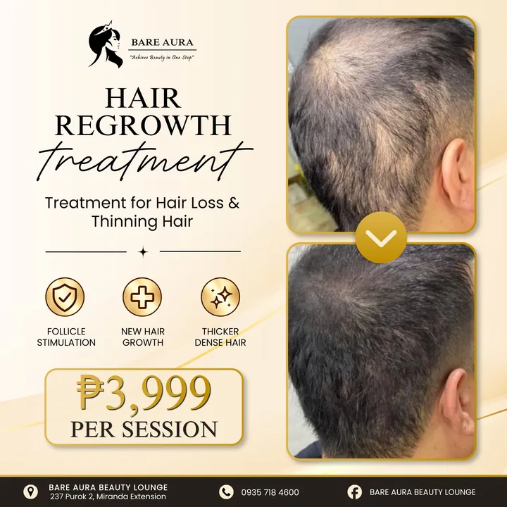 Before-and-after post: hair regrowth treatment